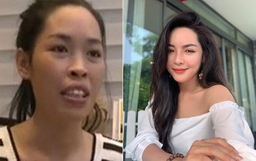 Sau 5 năm phẫu thuật thẩm mỹ thay đổi dung mạo, cuộc sống của cô gái Vũ Thanh Quỳnh đã có sự chuyển biến rõ rệt. Ngoài ra, cô cũng ngày càng ăn mặc sang chảnh, sành điệu hơn.