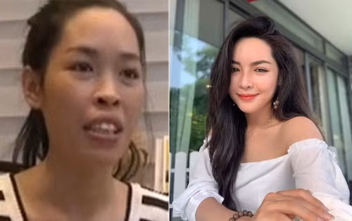 Sau 5 năm phẫu thuật thẩm mỹ thay đổi dung mạo, cuộc sống của cô gái Vũ Thanh Quỳnh đã có sự chuyển biến rõ rệt. Ngoài ra, cô cũng ngày càng ăn mặc sang chảnh, sành điệu hơn.