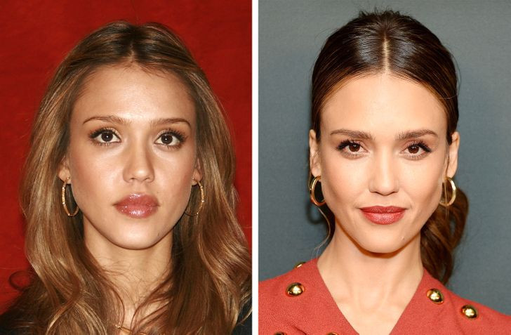 Môi bé lại, mất độ ẩm: Thực tế, hình dạng của đôi môi của bạn sẽ thay đổi theo năm tháng. Chúng ngày càng nhỏ, trở nên khô hơn, xuất hiện nhiều nếp nhăn. Theo năm tháng, đôi môi căng mọng và gợi cảm sẽ bé dần đi và mỏng hơn trông thấy.