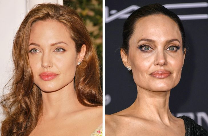 Quầng thâm xuất hiện dưới mắt: Lớp mỡ dưới da trở nên mỏng hơn do sản xuất collagen ít đi sau tuổi 30. Vùng da quanh mắt mất dần mật độ, trở nên trong suốt hơn và bắt đầu xuất hiện các mạch máu, sau đó dẫn đến sự xuất hiện quầng thâm dưới mắt.