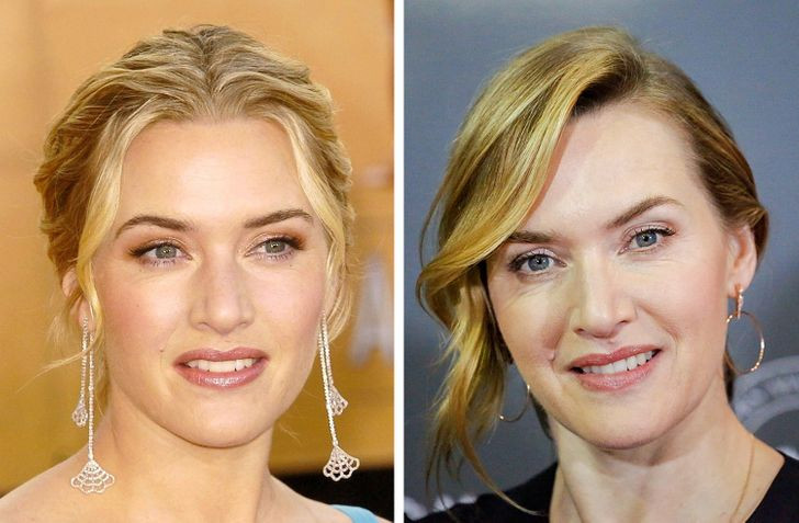 Nước da xỉn dần và mất vẻ căng bóng: Không thể không nhận thấy rằng làn da mất đi vẻ khỏe mạnh và tươi sáng, trở nên xỉn màu hơn theo tuổi tác. Nguyên nhân chính là do giảm tổng hợp collagen và elastin. Ngoài ra, chăm sóc không đủ hoặc không đúng cách, thiếu ngủ, mệt mỏi, chế độ ăn uống không lành mạnh và thói quen xấu cũng góp phần vào quá trình này.