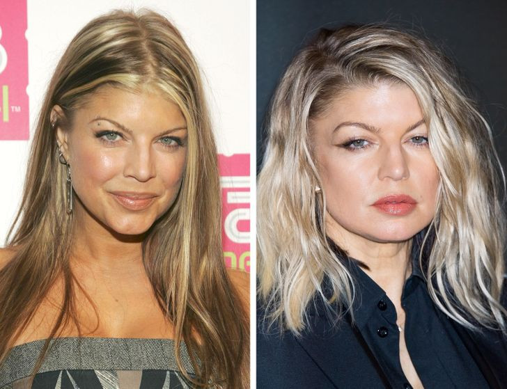 Khuôn mặt V-line bị đảo ngược: Khi còn trẻ, khuôn mặt khiến ta liên tưởng đến hình tam giác với đỉnh hướng xuống dưới, đáy dọc theo trán. Đó được gọi là "tam giác của tuổi trẻ". Càng ngày, lớp mỡ dưới da càng "trượt" xuống, má mất đi độ đàn hồi và khuôn mặt có các nếp gấp ở mũi. Vì vậy, tam giác này sẽ dốc ngược theo năm tháng.