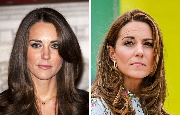 Đuôi mắt, khóe môi rủ xuống: Khóe môi và mắt khiến khuôn mặt có vẻ mệt mỏi. Điều này đặc biệt phù hợp với những người không thường xuyên cười - cơ mặt hỗ trợ khóe miệng suy yếu nhanh hơn nhiều. Vùng da quanh mắt của chúng ta cũng mất đi độ đàn hồi và săn chắc theo năm tháng, các gân và cơ ở vùng này yếu đi không còn có thể “giữ vững” khóe mắt như ngày xưa. Ảnh: BS.