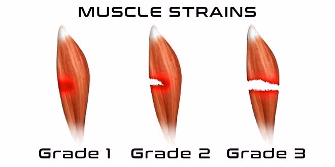 Tap nhay cuong do cao, Chi Pu bi rach co dui... co nguy hiem?-Hinh-2