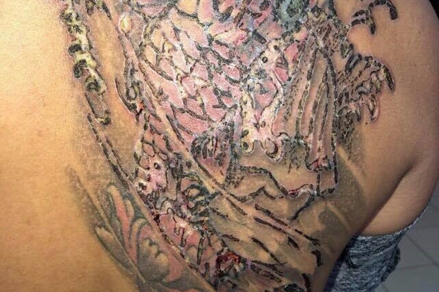 Tham hoa kinh hoang vi xoa xam khien nhieu nguoi “so khoc thet”-Hinh-2