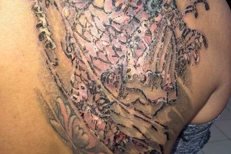 Tham hoa kinh hoang vi xoa xam khien nhieu nguoi “so khoc thet”-Hinh-2