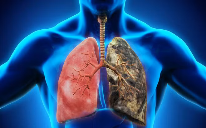 Bên cạnh đó, bạn cũng nên bổ sung những thực phẩm có tác dụng thanh lọc, giải độc, làm sạch phổi mạnh nhất mà chúng ta nên bổ sung nhiều hơn vào thực đơn ăn uống, đặc biệt là đối với người hút thuốc.