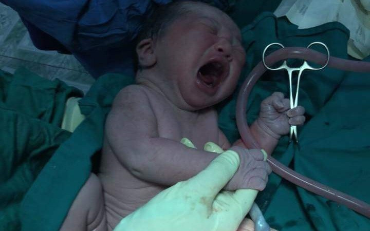 Trước đó, hình ảnh một em bé sơ sinh tay cầm kéo cũng khiến dân mạng thích thú. Em bé này có bố là 1 HLV võ cổ truyền. Và dường như được di truyền luôn nghề của bố, khi bác sĩ vừa đưa kéo vào để cắt dây rốn thì cậu bé đã "tước" luôn cây kéo phòng vệ như thật. Mời độc giả xem video "Bé sơ sinh bị bỏ rơi dưới hố ga đã qua đời". Nguồn: VTC Now.