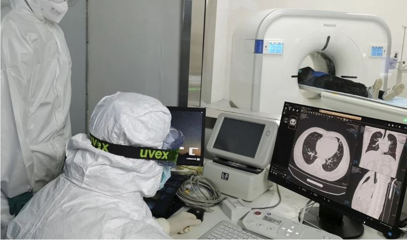 Virus gay COVID-19 con ton tai sau trong phoi nguoi khoi benh