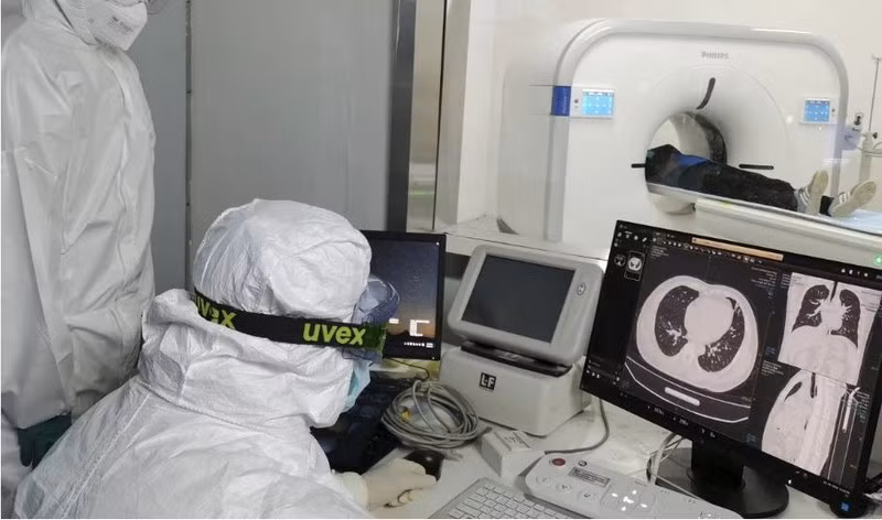 Virus gay COVID-19 con ton tai sau trong phoi nguoi khoi benh