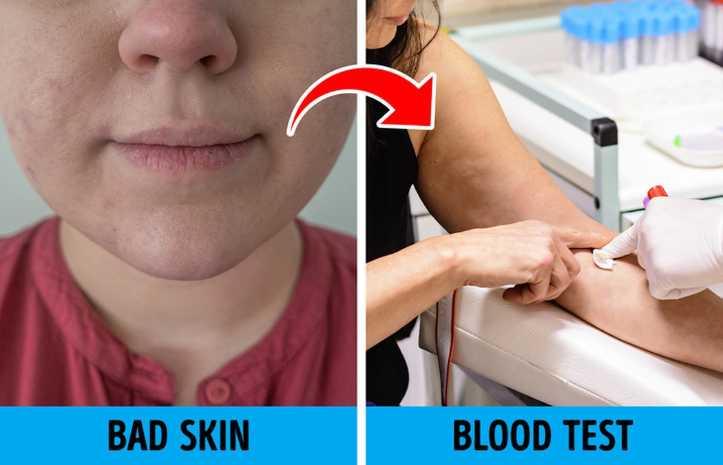 Không kiểm tra mức hoóc môn: Theo tuổi tác, nồng độ hoóc môn thay đổi và nếu mất cân bằng, sẽ ảnh hưởng đến toàn bộ cơ thể. Nếu các tuyến không tiết đủ hoóc môn, có thể dẫn đến lão hóa. Nên làm xét nghiệm hoóc môn trong máu mỗi năm 1 lần. Ảnh: Bright Side. Video "Dầu thực vật có thực sự tốt cho sức khỏe?". Nguồn: VTC.