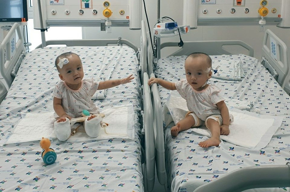 Sáng 18/8, tại phòng điều trị chăm sóc đặc biệt khoa Hồi Sức Tim- Ngoại của Bệnh viện Nhi đồng TP HCM, hai bé song sinh Trúc Nhi-Diệu Nhi đã “tay bắt mặt mừng” gặp lại nhau sau hơn một tháng phải “cách ly” do ca mổ tách.