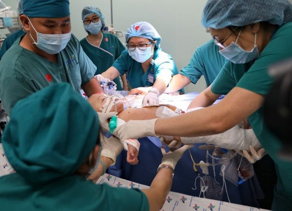 Các bác sĩ nhận định dù cuộc mổ thành công, việc chăm sóc, hồi sức và vật lý trị liệu cho hai bé để tìm lại sự bình thường mới là đích đến. Ảnh: FBBV.