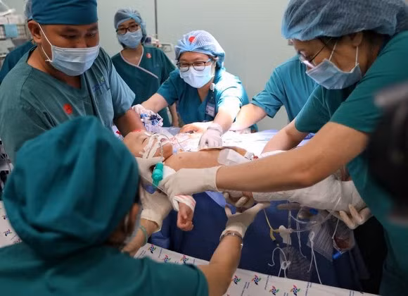 Các bác sĩ nhận định dù cuộc mổ thành công, việc chăm sóc, hồi sức và vật lý trị liệu cho hai bé để tìm lại sự bình thường mới là đích đến. Ảnh: FBBV.