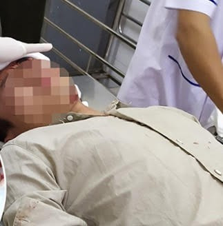 Dieu tra nhom nguoi xong vao tram kiem lam hanh hung nhan vien, cuop di xe may