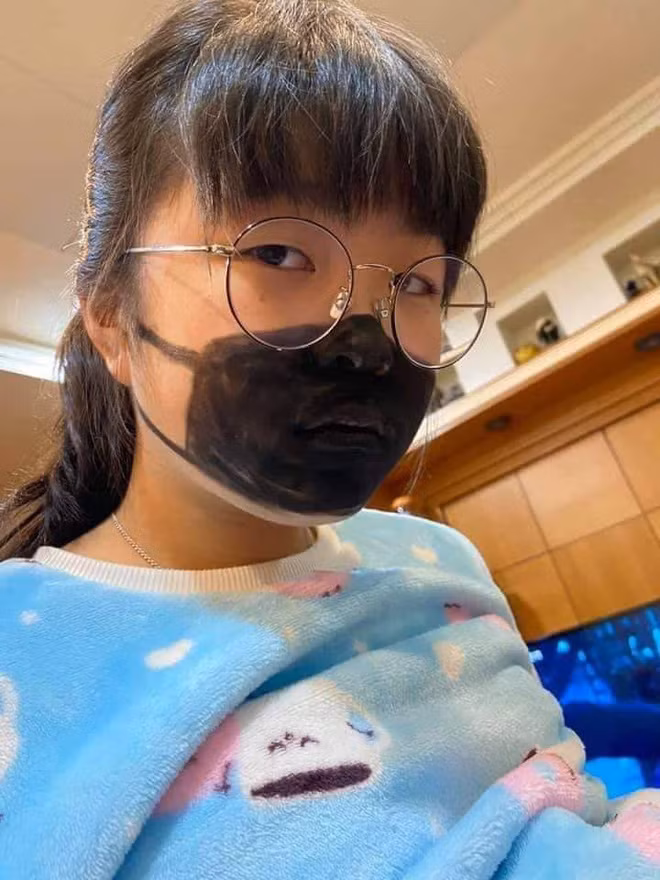 Tu che khau trang vi lo Corona, co be khien dan mang ngac nhien khi vua he mieng