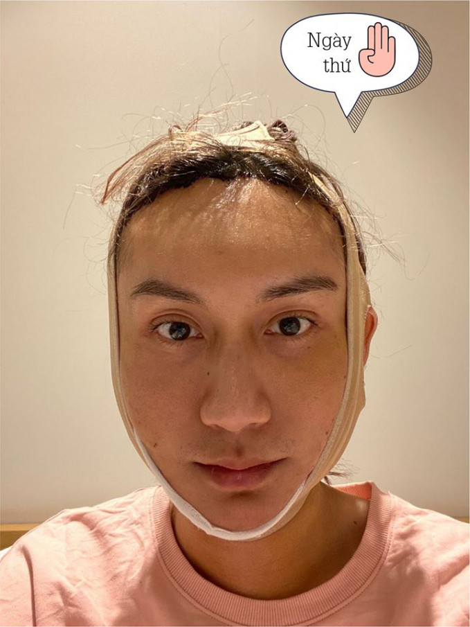 Tuy nhiên, người đẹp này vẫn lạc quan chia sẻ: "Xem xong các bạn sẽ sốc lắm đấy. Nhưng thề là Linh không hề đau như các bạn đang tưởng, chả hiểu sao lại thế luôn ý. Linh chỉ thấy nó như một giấc ngủ, dậy mọi thứ đã xong xuôi, chỉ có điều cơ thể hơi mệt xíu nhưng mà lại không đau tí nào.