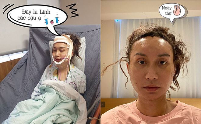 Mới đây, Lynk Lee vừa đăng tải những tâm sự về hành trình thực hiện phẫu thuật chuyển giới để sở hữu một khuôn mặt và vóc dáng xinh đẹp, nữ tính.