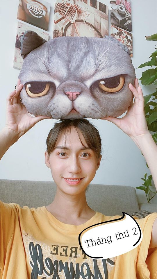 Sau hai tháng thực hiện cuộc đại phẫu, gương mặt của Lynk Lee đã hài hòa và thon thả hơn.