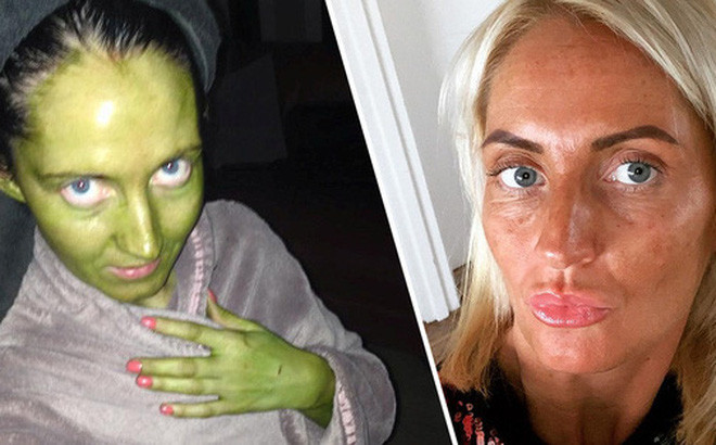 Hoang hon nguoi phu nu da xanh nhu ech vi su dung my pham het han