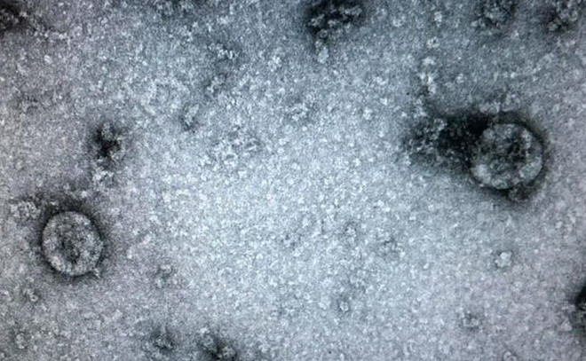 Virus corona chung moi o Da Nang: “Ho hang” cua chung o Bac Kinh?