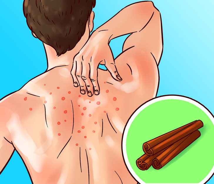 7. Quế: Quế có thể giúp chống nhiễm trùng cơ thể và sửa chữa tổn thương mô. Nó cũng chống viêm và có thể làm giảm nguy cơ mắc bệnh tim. Ngoài ra, quế cũng có thể giúp chống lại nhiễm trùng vi khuẩn và thậm chí bảo vệ bạn khỏi ung thư. Gia vị này có thể thêm vào trà, bánh, cà phê...