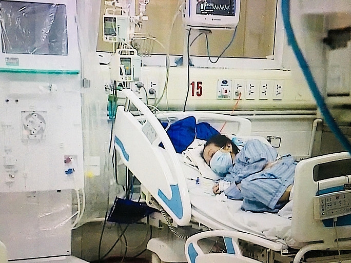 Su phuc hoi ky dieu cua benh nhan COVID-19 thu 19 sau 3 lan ngung tuan hoan