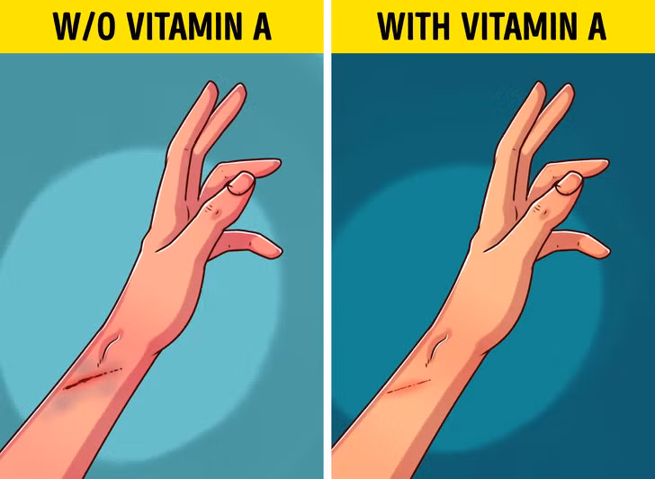 Vết thương lâu lành: Cơ thể nhanh lành vết thương nhờ sự sản sinh collagen. Vitamin A giúp cơ thể sản sinh ra collagen, do đó nếu thấy vết thương trên da lâu lành thì bạn nên kiểm tra xem chế độ dinh dưỡng có nạp đủ vitamin A hay không.