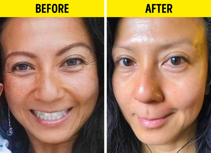 6 loi ich cua serum vitamin C voi lan da khien chi em 