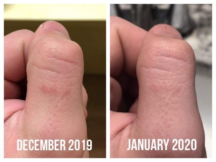 6 loi ich cua serum vitamin C voi lan da khien chi em 