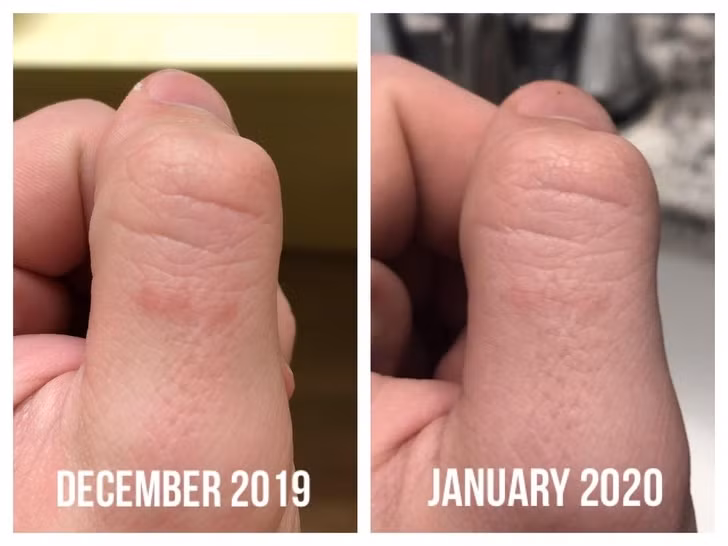 6 loi ich cua serum vitamin C voi lan da khien chi em 