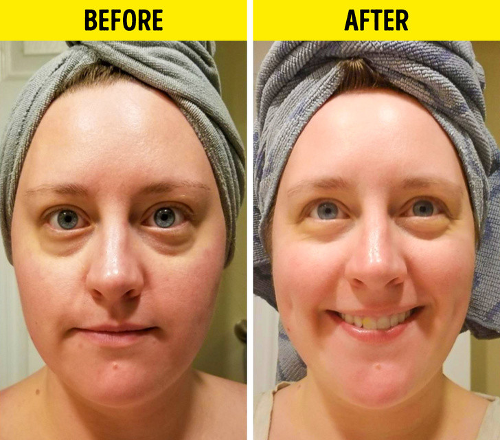 6 loi ich cua serum vitamin C voi lan da khien chi em 