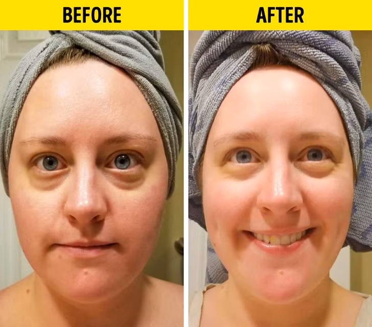 6 loi ich cua serum vitamin C voi lan da khien chi em 