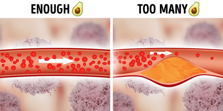 Quả bơ: Loại quả này chứa rất nhiều chất xơ và vitamin, giúp làm giảm các cholesterol xấu và duy trì hoạt động của các tế bào. Tuy nhiên, 1 quả bơ bình thường chứa tới 240 calo (chiếm khoảng 10 – 20% lượng calo cần thiết cho 1 người/ngày). Do vậy, ăn quá nhiều bơ cũng khiến bạn bị tăng cân và gây ra các vấn đề về tắc nghẽn động mạch.