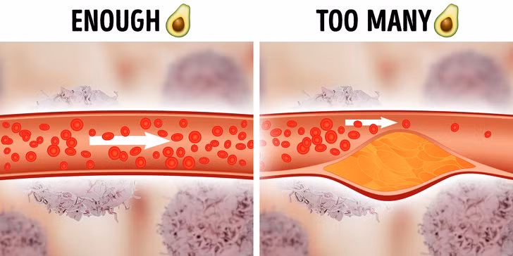 Quả bơ: Loại quả này chứa rất nhiều chất xơ và vitamin, giúp làm giảm các cholesterol xấu và duy trì hoạt động của các tế bào. Tuy nhiên, 1 quả bơ bình thường chứa tới 240 calo (chiếm khoảng 10 – 20% lượng calo cần thiết cho 1 người/ngày). Do vậy, ăn quá nhiều bơ cũng khiến bạn bị tăng cân và gây ra các vấn đề về tắc nghẽn động mạch.