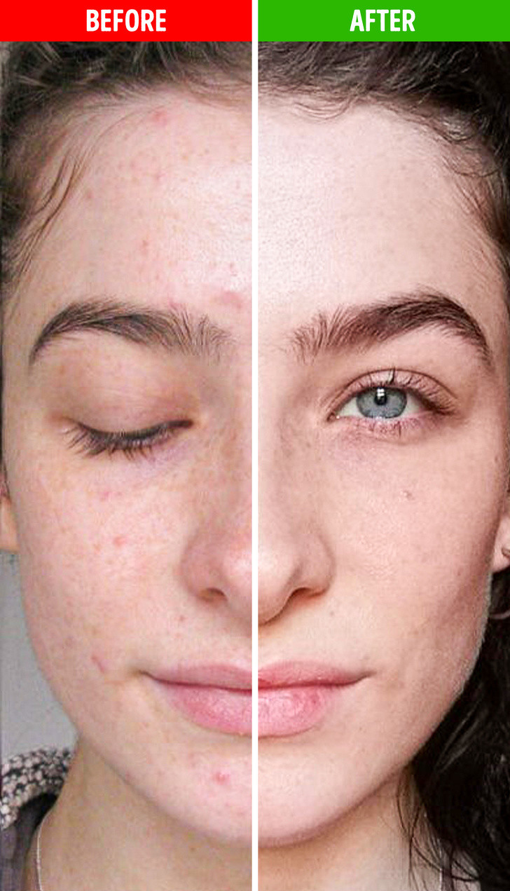 Giảm viêm: Ăn đu đủ thường xuyên giúp bạn ngăn ngừa tình trạng viêm da và các vấn đề liên quan tới khớp như: viêm khớp, đau khớp, bệnh gout và hen suyễn.