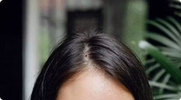 Phu nu co 4 not ruoi nay thi phu quy ca doi