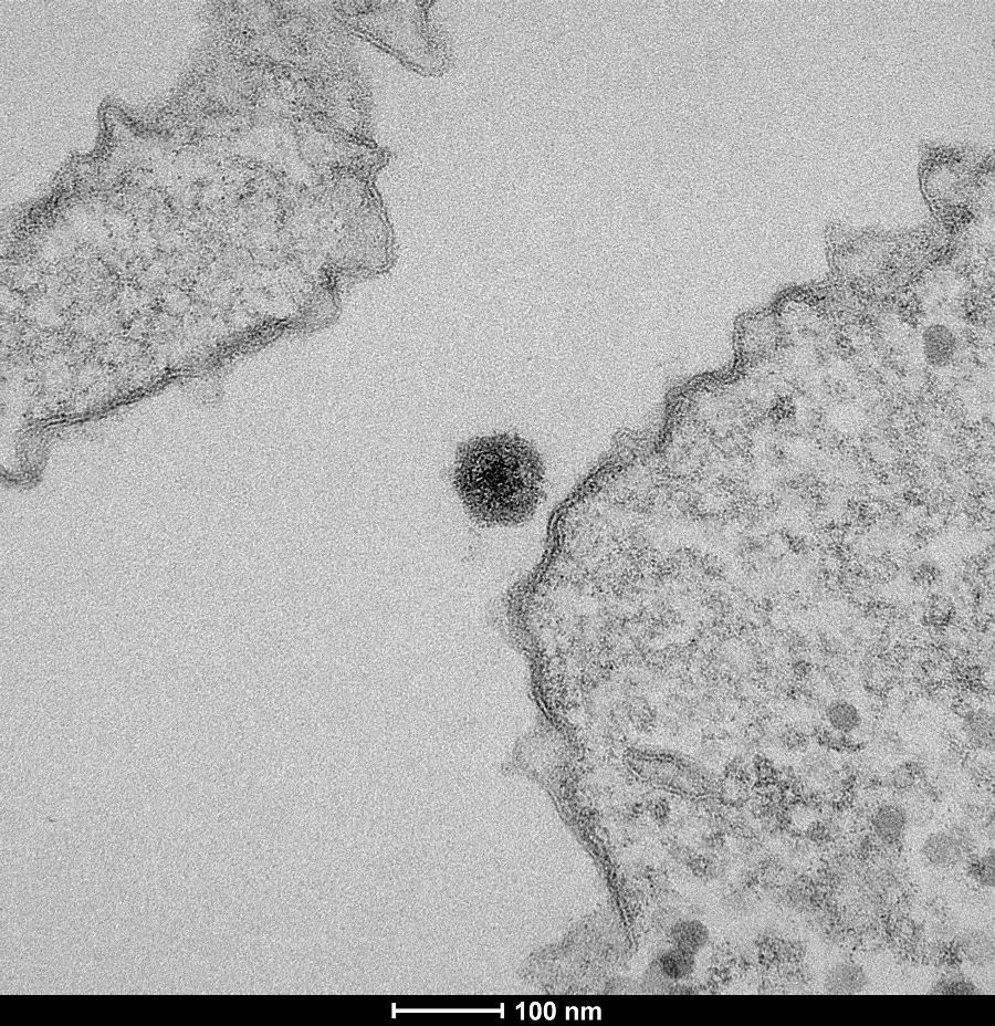 Mặc dù Yaravirus có khả năng truyền sang người, nhưng không có dấu hiệu cho thấy nó là mối đe dọa đối với sức khỏe của chúng ta.