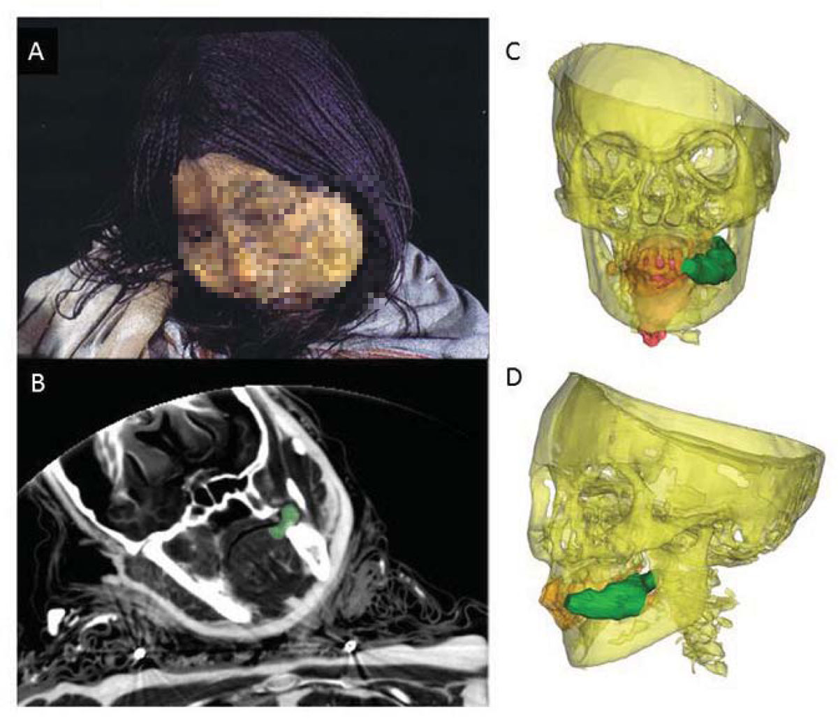 Cô gái đã được làm quen với tình trạng vô thức nhờ sử dụng lá cocaine trong suốt một năm trước khi bị hiến tế. Nhóm nghiên cứu nhận thấy cô ra đi một cách yên bình, không có dấu hiệu bạo lực hay phản kháng.
