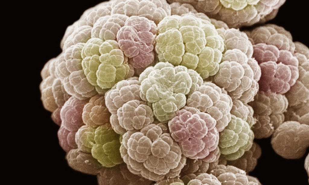 Cách đây khoảng 4 tỷ năm, tồn tại một vi khuẩn gọi là LUCA (Last Universal Common Ancestor) - tổ tiên chung cuối cùng của tất cả các loài trên Trái Đất. LUCA có thể đã sống trong môi trường “ngoại hành tinh” dưới lòng đất, ẩn mình sâu trong các khe nước nóng giàu sắt lưu huỳnh. (Ảnh: Daily Mail)