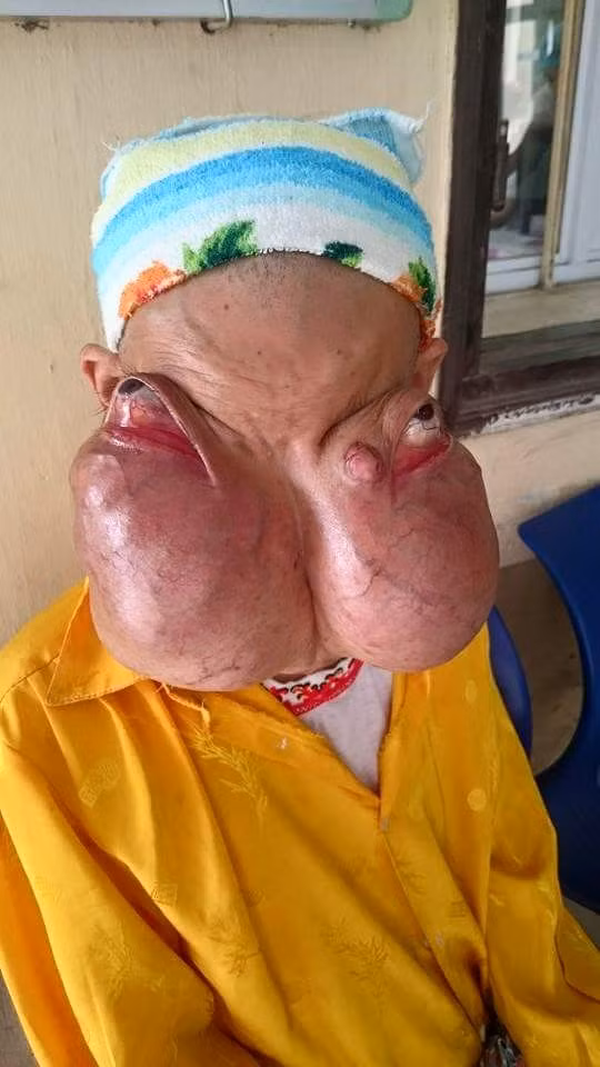 Xot long nguoi phu nu 