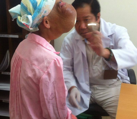 Mo cho benh nhan co hai khoi u khong lo tren mat