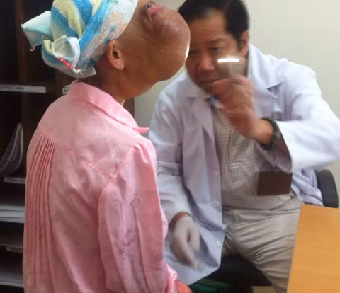 Mo cho benh nhan co hai khoi u khong lo tren mat