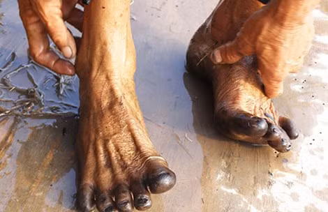 Giai ma hien tuong chan den nhu muc Tau sau loi ruong