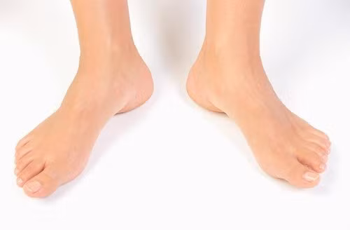 Các mô mỡ xung quanh gân và bắp chân sẽ được phẫu thuật hút mỡ việc phẫu thuật này khá đơn giản và không ảnh hưởng quá nhiều tới chân như phẫu thuật kéo dài chân hay gọt chân.