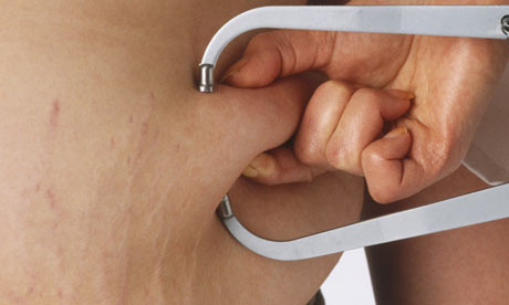 Cay hat phong xa chua khoi ung thu tuyen tien liet