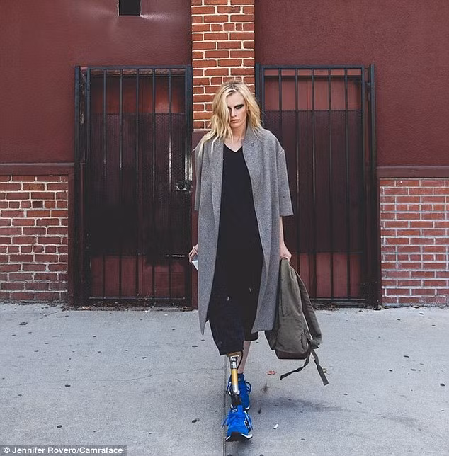 Lauren Wasser, 28 tuổi bị nhiễm hội chứng sốc độc băng vệ sinh hồi năm 2012. Thế nhưng sau đó cô đã nỗ lực vươn lên để trở thành một người mẫu ảnh đặc biệt, dù cho đôi chân không còn. Thi thoảng người mẫu cụt chân này còn nhận lời biểu diễn trên sàn catwalk.