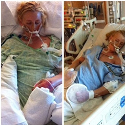 Lauren chìm vào tình trạng hôn mê, chỉ còn sống được qua ống thở. Nhiễm trùng ở chân đã gần đến hoại tử và có thể lan dần đến toàn cơ thể nếu như không cắt cụt bàn chân phải sớm.