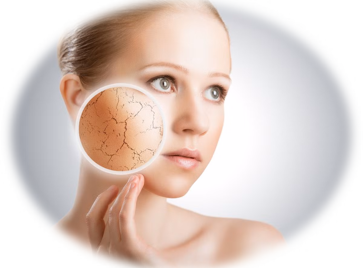 Nứt nẻ, khô da. Khi dùng máy sưởi, chúng ta thường đóng kín cửa phòng và khiến không khí lưu thông kém dẫn đến việc da bị khô. Nếu dùng lâu dài thì dâ sẽ bị nứt nẻ và thô ráp.