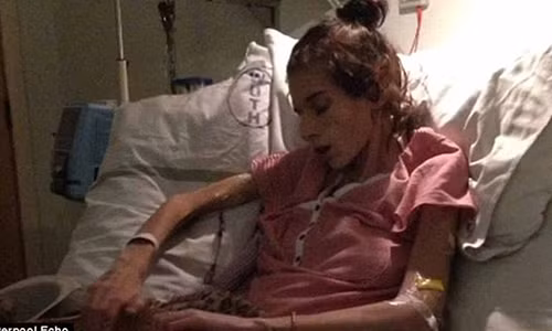 Nhưng khi cơn đau trở nên trầm trọng, cô nhập viện và được chẩn đoán ung thư thì các tế bào ung thư đã lan rộng trên khắp cơ thể. Thật đáng tiếc là cô người mẫu xinh đẹp này đã không giữ được mạng sống vì sự chủ quan của đội ngũ bác sỹ.